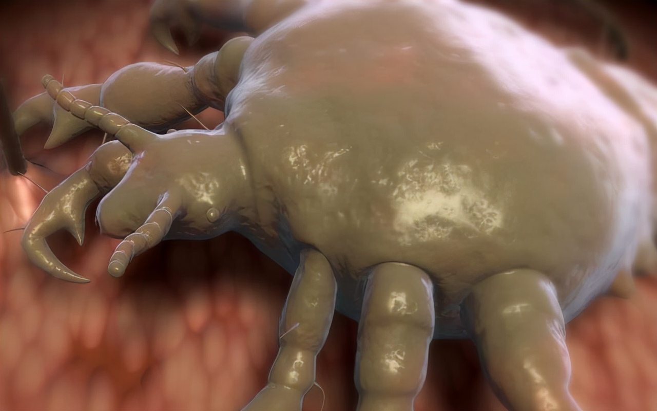 什么情况下会产生阴虱病,什么是阴虱怎么治