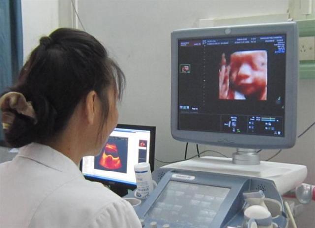 宝宝四维照片和生下来照片对比,四维照片所有宝宝都长得一样吗