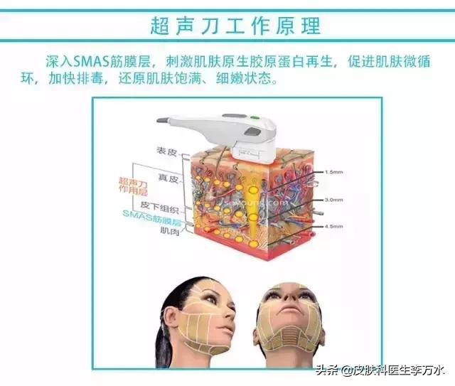 超声刀美容真的像张雨绮吗,张雨绮超声刀图片