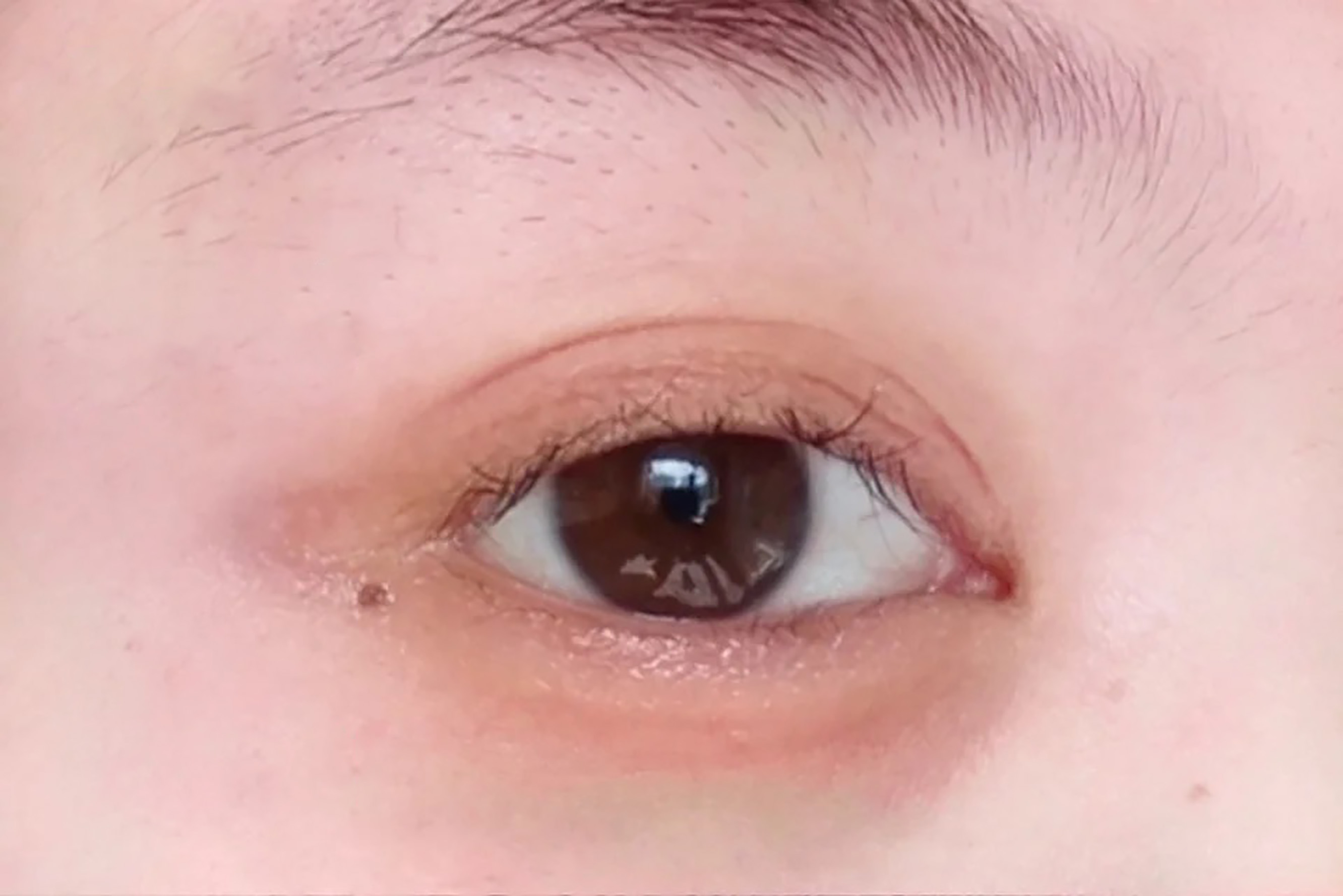 5分钟带你了解眼部问题，面对眼纹不惊慌，快来抄作业