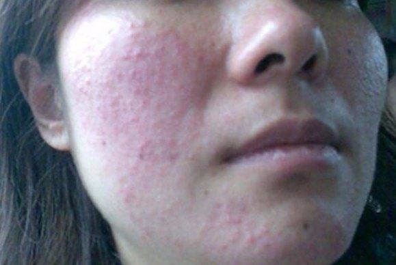 芭宝丽防晒霜敏感肌能用吗,抗过敏防晒霜bb霜