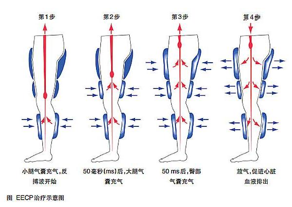 详细了解冠心病的治疗好方法，可惜知道的人太少了