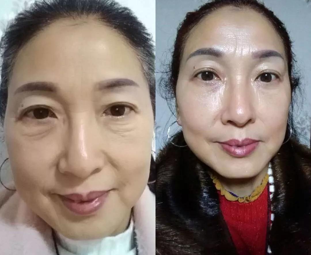 眼袋大显老试试这个方法简单实用,眼袋显老怎么办四种方法帮你去掉