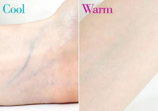 黄黑皮染什么发色显白高级洋气,显白发色黄黑皮推荐