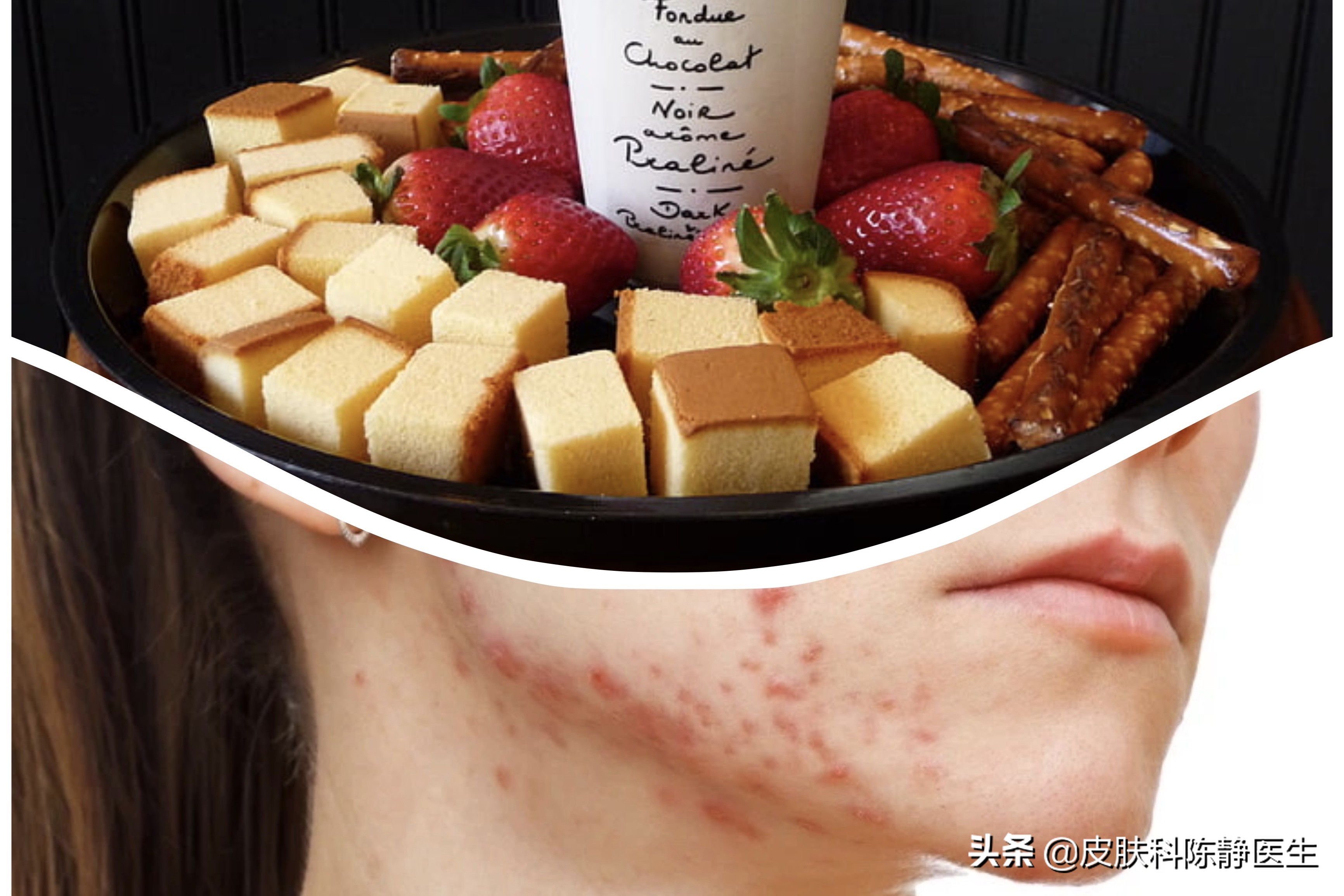 不吃药光靠运动能治疗焦虑症,不用吃药也能变强