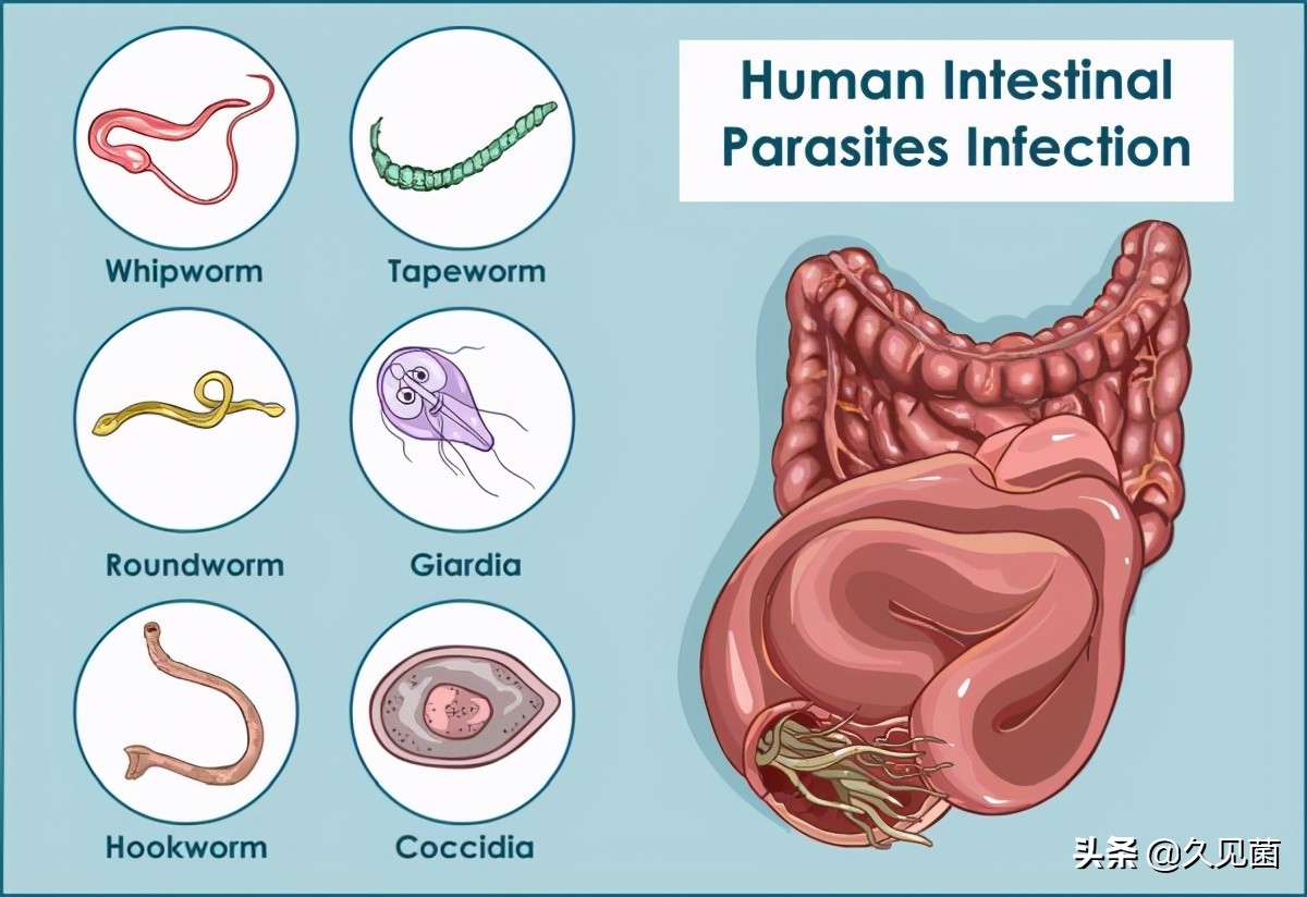 寄生虫灭绝了对生态有影响吗,寄生虫离开人体多久会死亡
