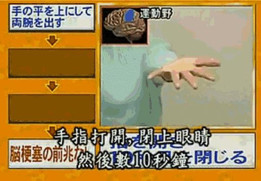 脑梗塞怎么通俗易懂的讲解 (日本专家如何判断脑梗塞前兆)