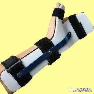 腕管综合征严重了可以不做手术吗,腕管综合征不治疗能养好吗