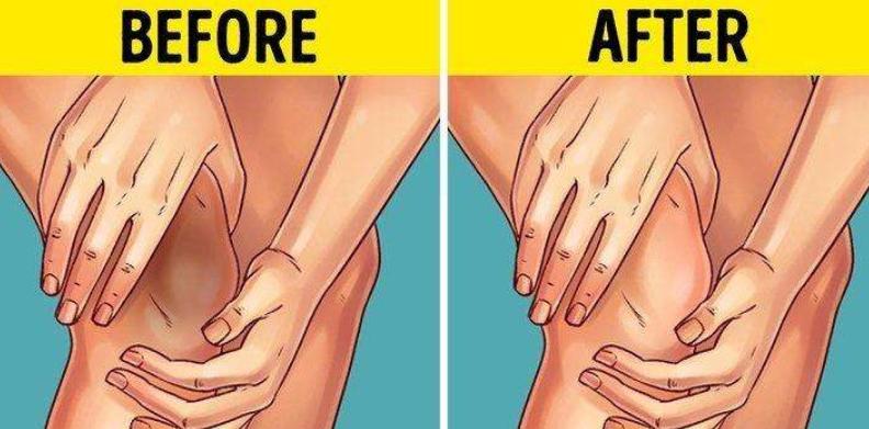 胳膊肘和膝盖黑怎么变白,手臂膝盖处黑要怎么美白