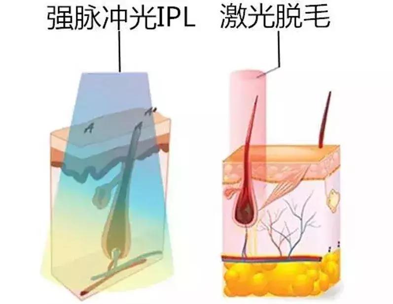 现在什么美容项目最赚钱最火,美容最挣钱的仪器