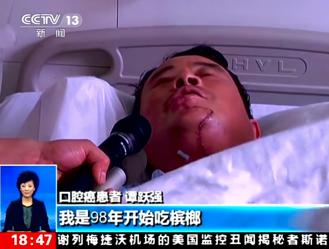 “500万人的口腔疾病,复发率50%,5年生存率只有一半…”