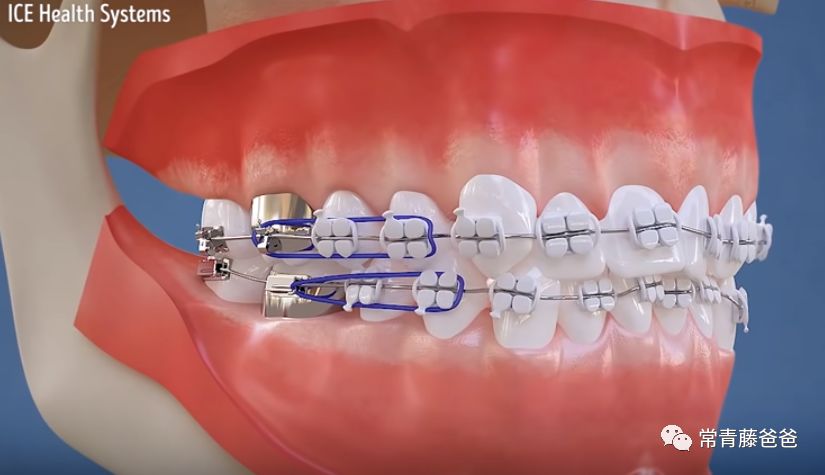 爱牙日保护你的口腔健康,爱牙日从定期口腔检查开始