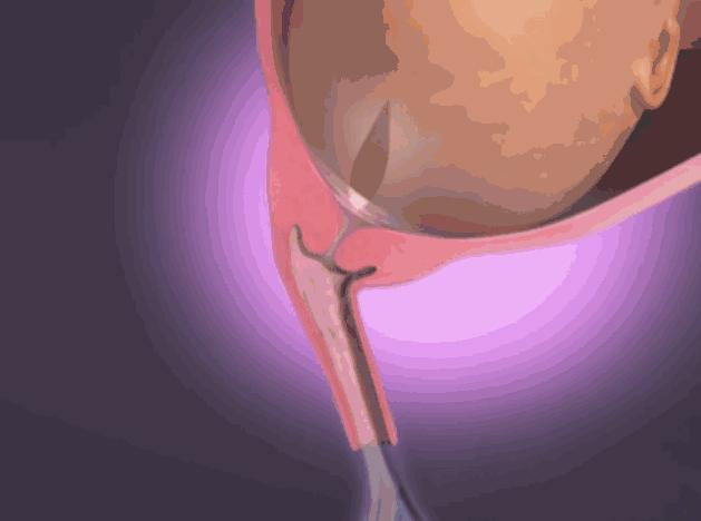 为什么胎水叫羊水,包裹胎儿的水为什么叫羊水