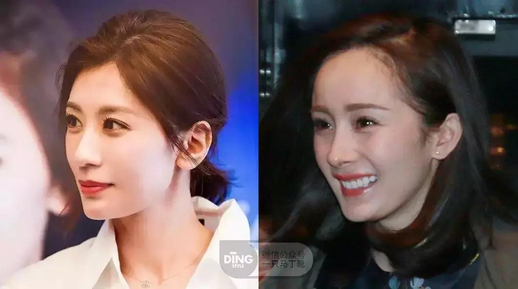 为了变美去整容,整牙堪比整容聊聊我的亲身经历