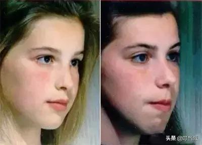 8岁的男孩睡觉打呼是怎么回事,8岁小孩晚上睡觉打呼是什么原因