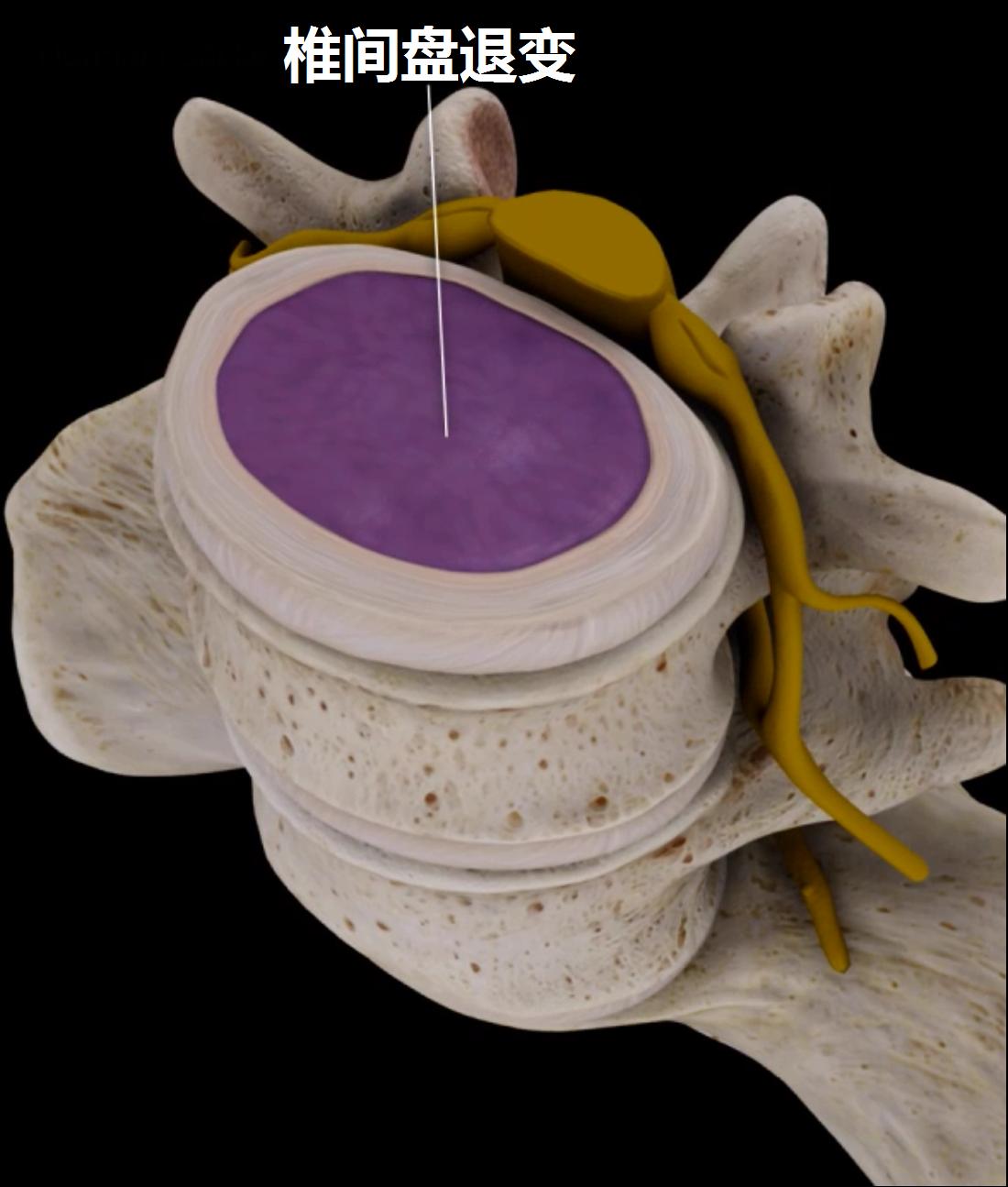 介绍一下治腰痛小窍门,不同腰痛的诊断与治疗