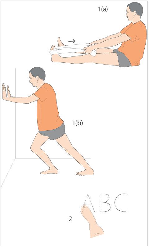 治疗扁平足,女生扁平足