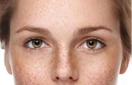 叙美雅祛斑会使角质层变薄吗,叙美雅祛斑小知识