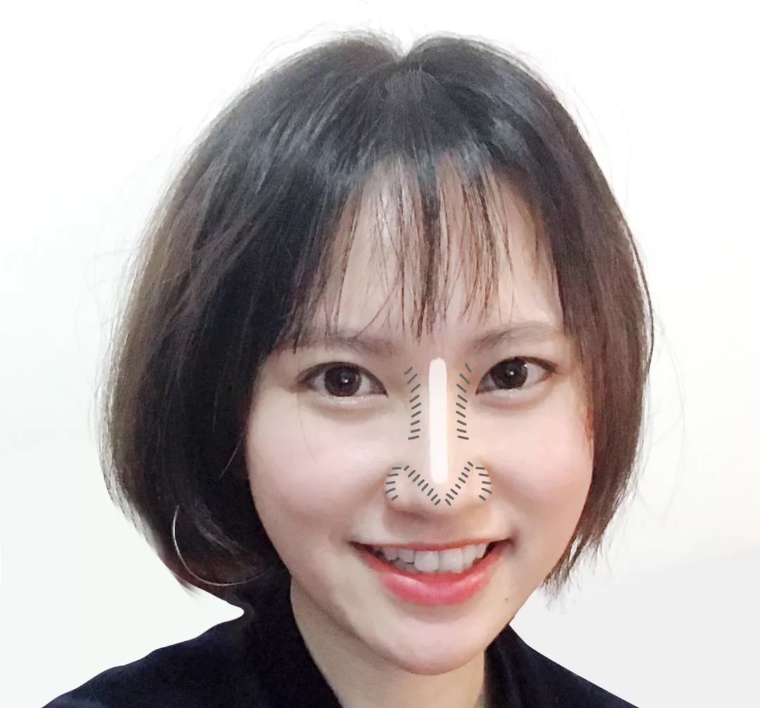 6种整容级鼻型修容法,蒜头鼻加朝天鼻修容