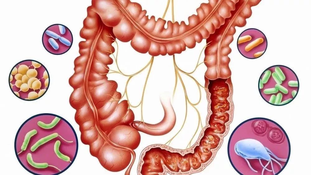 哪些问题属于内分泌失调,肠道菌群失调与甲状腺疾病有关