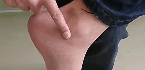 艾灸时感到酸、麻、胀、痛、痒？全面认识灸感，让艾灸事半功倍