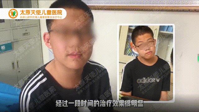 辗转多个医院14岁抽动男孩的求医道路，抽动症能治好？答案是可以