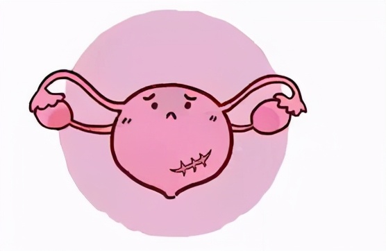 一个月有25天都在来月经,月经期的预警症状