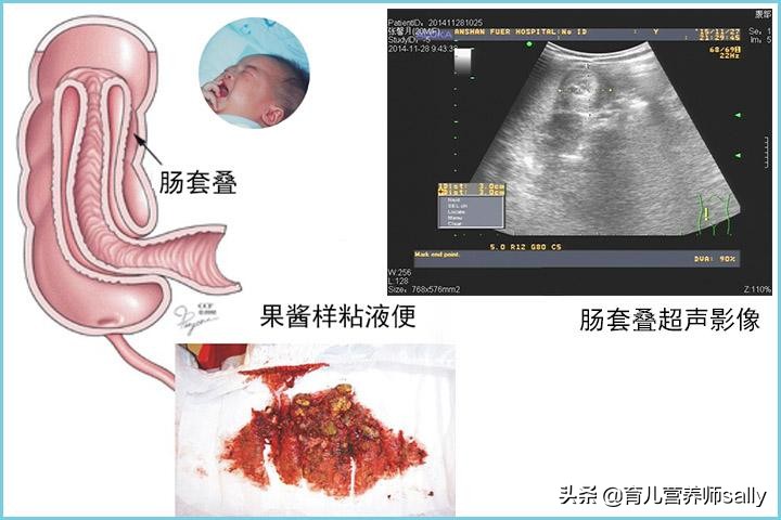 宝宝玩的好好的突然大哭,宝宝玩的好好的突然肚子剧痛