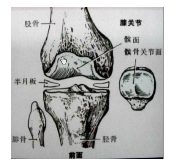 半月板损伤会造成膝盖不稳定吗,半月板长期不治有何危害