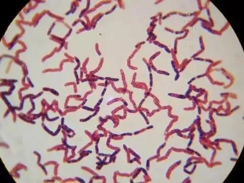 简单易懂的益生菌知识大全,微生物细菌小知识