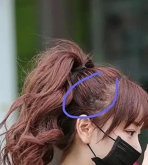 蒋梦婕有脱发困扰,女演员蒋梦婕现状