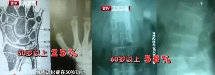 真正补钙的不是牛奶而是它,比喝牛奶更补钙的3个好方法