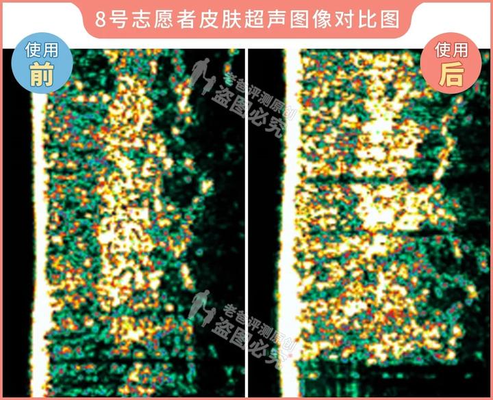 300块的网红美容仪有效果吗,网红家用美容仪测评