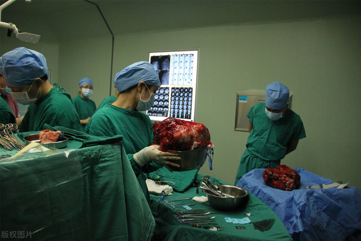 关于肿瘤治疗的几大误区,目前肿瘤治疗的最佳模式