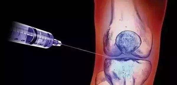 中医治疗类风湿性关节炎中成药,类风湿关节炎中医西医结合方案