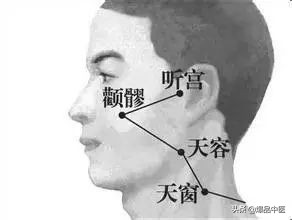 气虚型冠心病缓不过来气的急救穴,中医对心脏病的急救用穴是哪几个