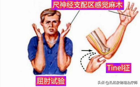 手指麻木是三大疾病前兆,手指麻木疼痛怎么治疗最好