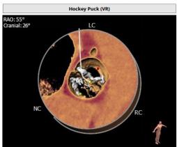 罗建方医生怎么样,罗建方教授