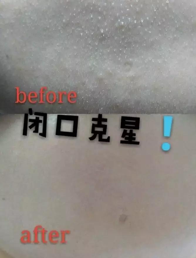 theordinary护肤品推荐,护肤圈成分theordinary