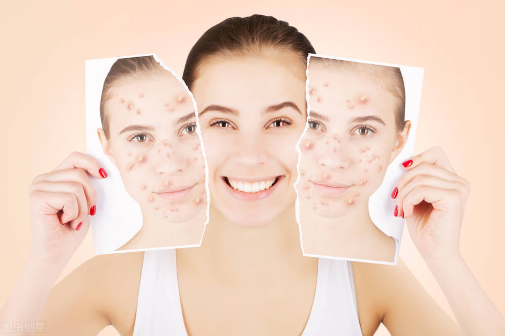 脸上长痘痘变成肉球怎么消除,脸上长痘痘硬块怎么快速消除