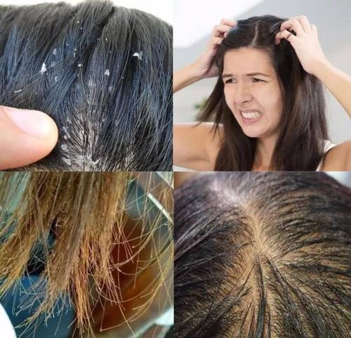 沙宣“退位让贤”，护发届翘楚“阿玛尼”上线，网友：良心洗发水