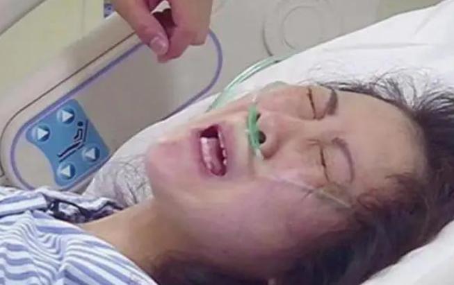 分娩备皮,分娩遇到男医生