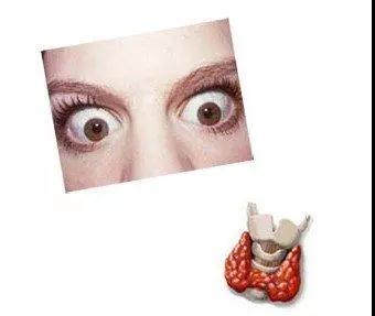 甲亢突眼恢复的最佳方法,简述甲亢患者突眼的保护措施