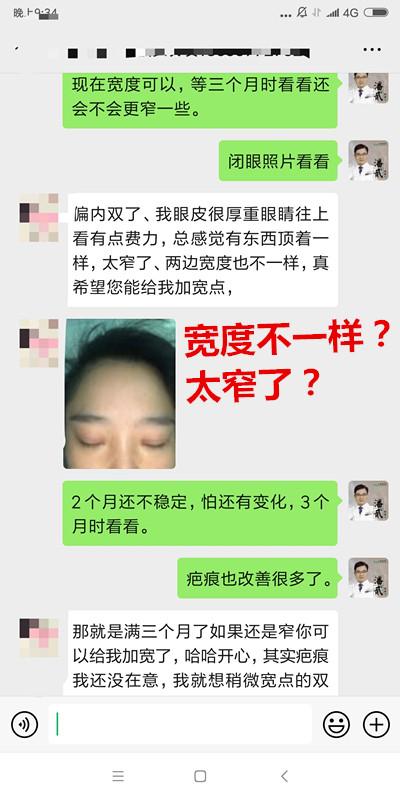双眼皮修复要对医生说实话吗,双眼皮失败可以修复的几率有多大