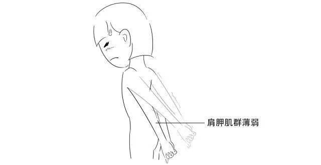 高低肩你怎么改善,怎样塑造好气质直角肩