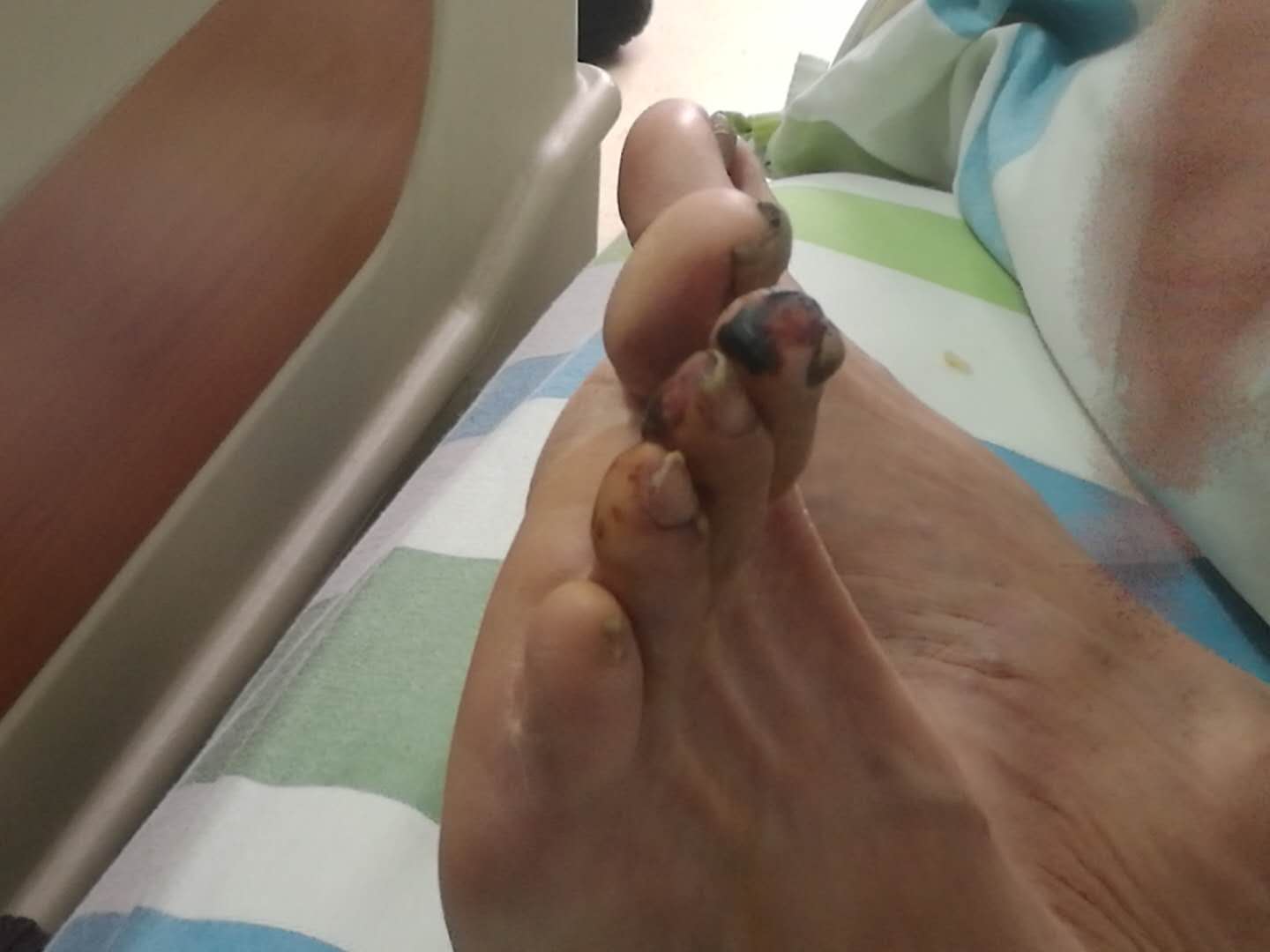 腿疼得要死是老寒腿吗,腿疼老寒腿怎么办