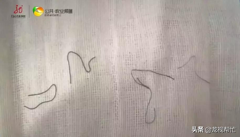 一女子减肥结果减出病了,中医埋线减肥出事