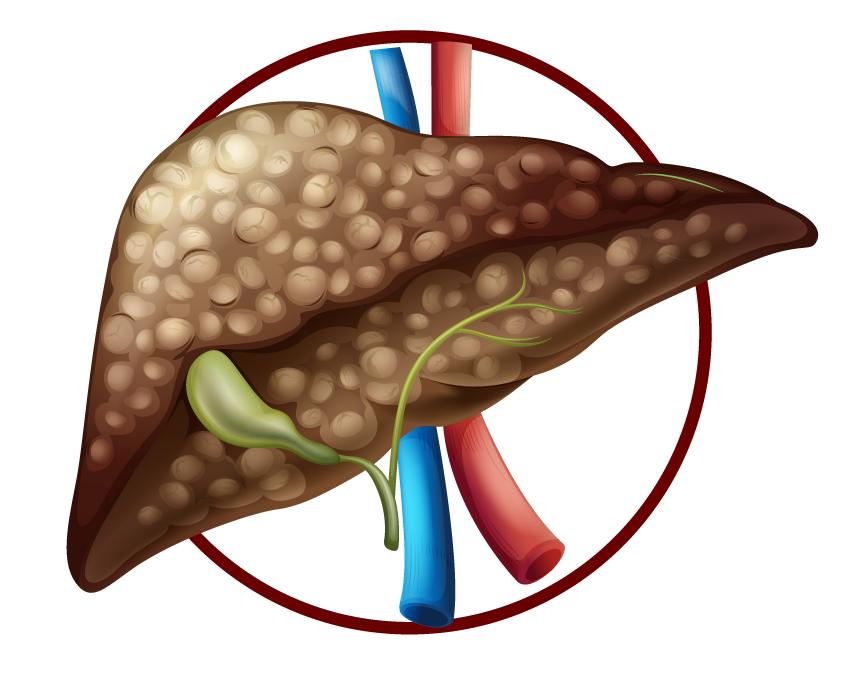 胰腺癌和肝癌患者吃什么食物好,肝癌高蛋白低脂肪的食物有哪些