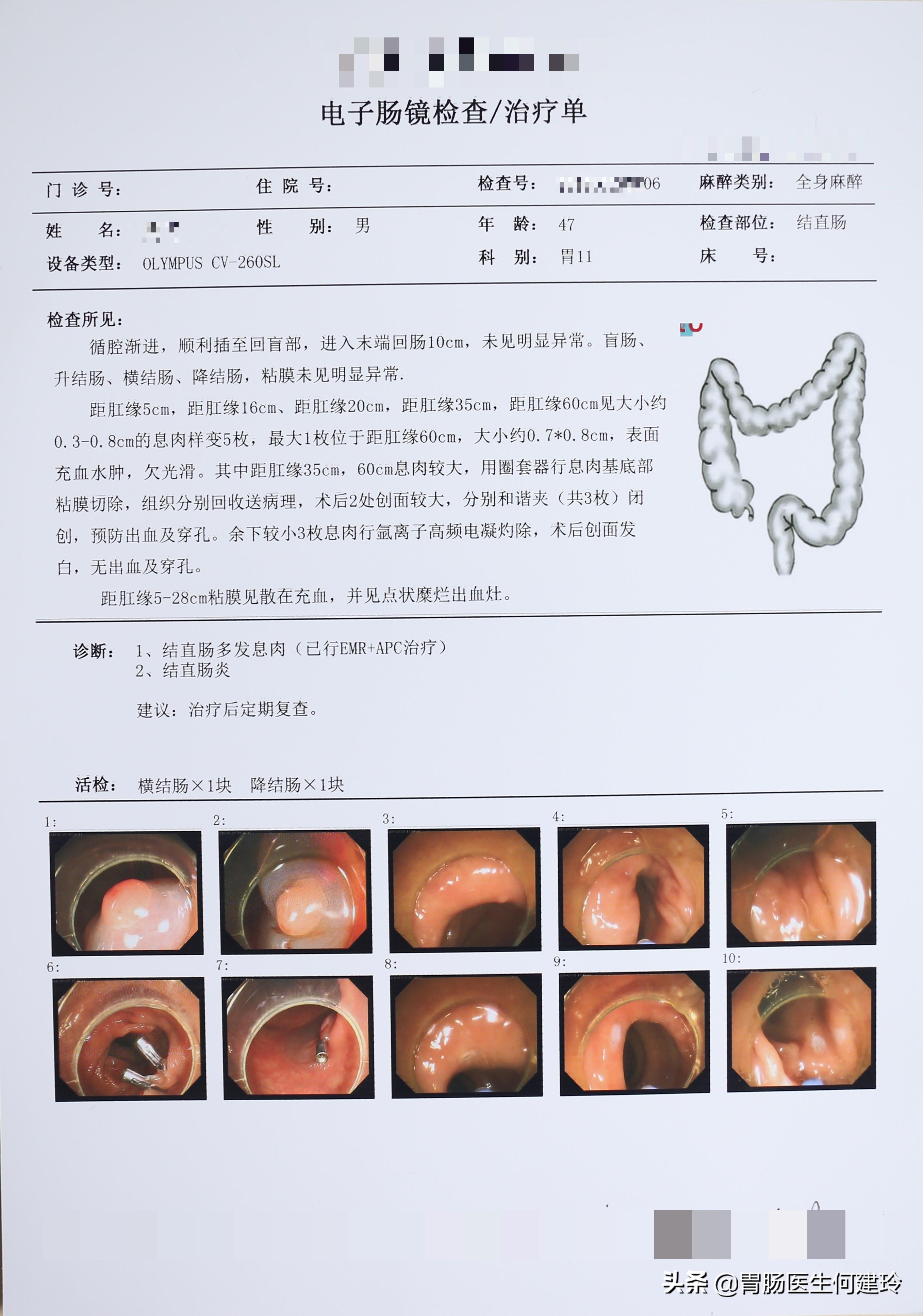 消化科医生有必要做肠镜吗,肠镜整个过程消化科医生能看到吗