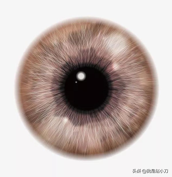 哪种型的白内障最严重呢,先天性白内障高危因素第10条